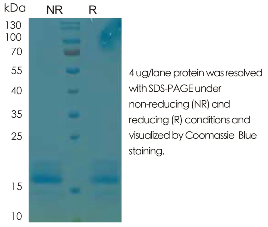 Mouse IL4 Recombinant Protein (HEK293 Expression) — Tag Free - Image 1