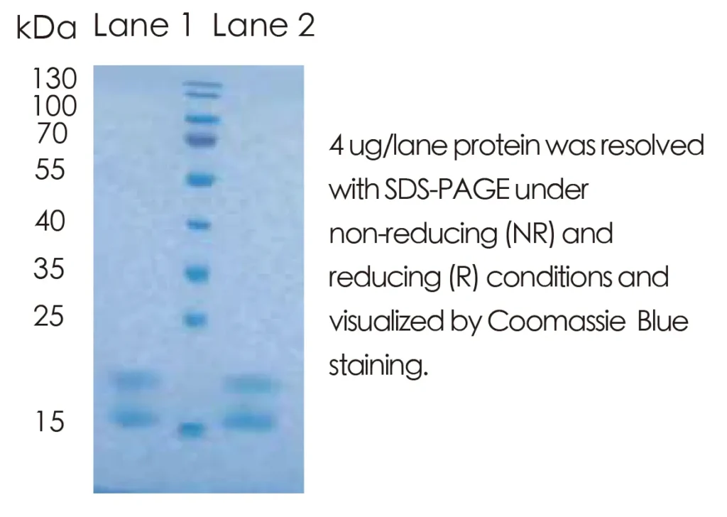 Mouse IL6 Recombinant Protein (HEK293 Expression) — Tag Free - Image 1