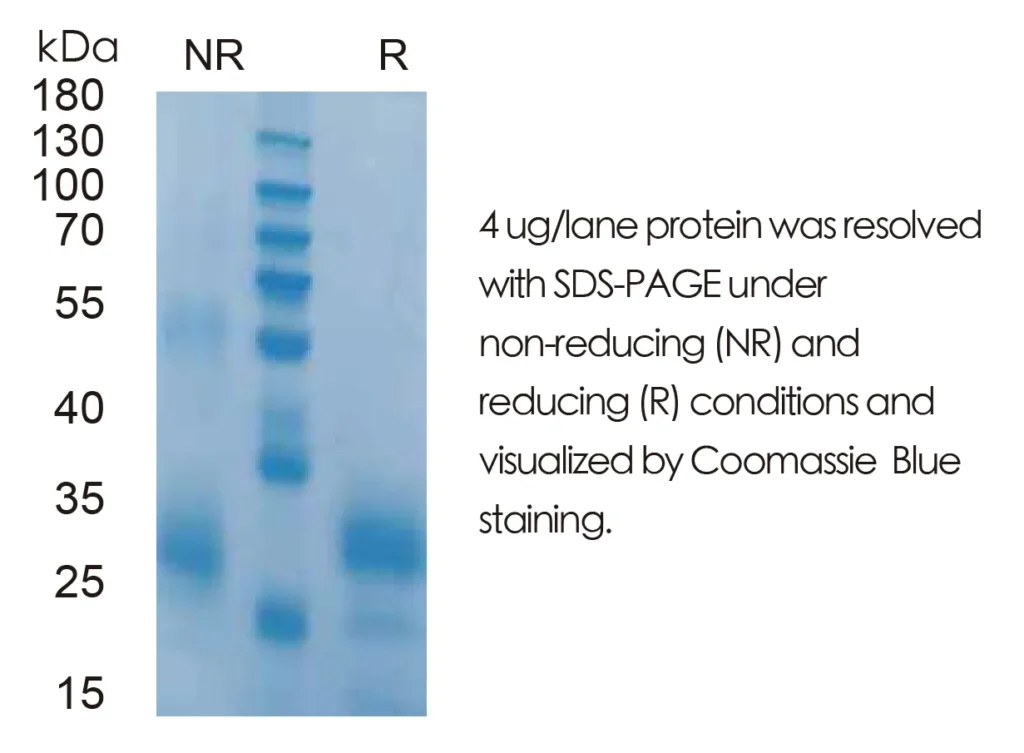 Mouse IL7 Recombinant Protein (HEK293 Expression) — Tag Free - Image 1
