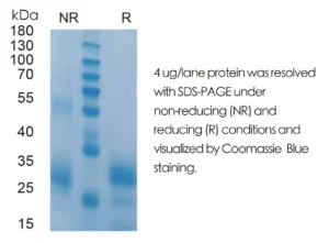 Mouse IL7 Recombinant Protein (HEK293 Expression) — Tag Free