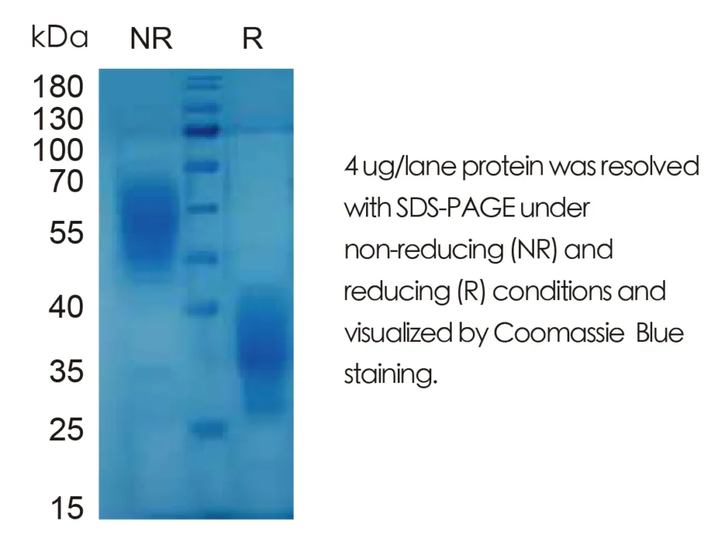 Mouse IL5 Recombinant Protein (HEK293 Expression) — Tag Free - Image 1