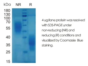 Mouse IL5 Recombinant Protein (HEK293 Expression) — Tag Free