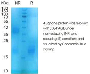 Human IL25 Recombinant Protein (HEK293 Expression)