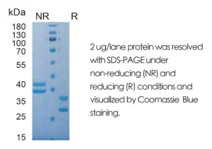 Human Prolactin Recombinant Protein (HEK293 Expression) — Tag Free