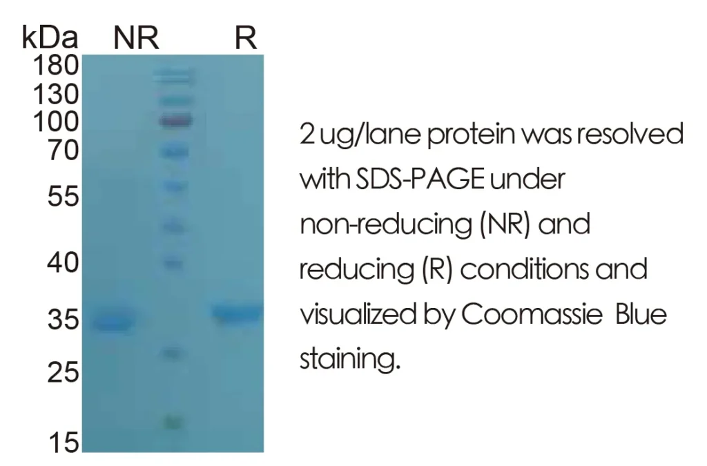 Human SHH Recombinant Protein (HEK293 Expression) — Tag Free - Image 1