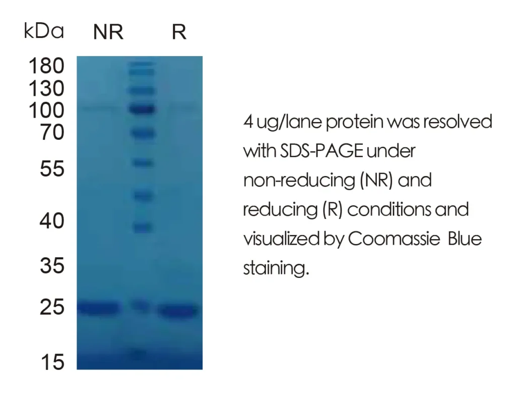 Mouse IL1a Recombinant Protein (HEK293 Expression) — Tag Free - Image 1