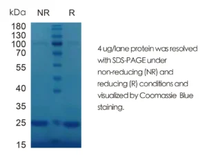 Mouse IL1a Recombinant Protein (HEK293 Expression) — Tag Free