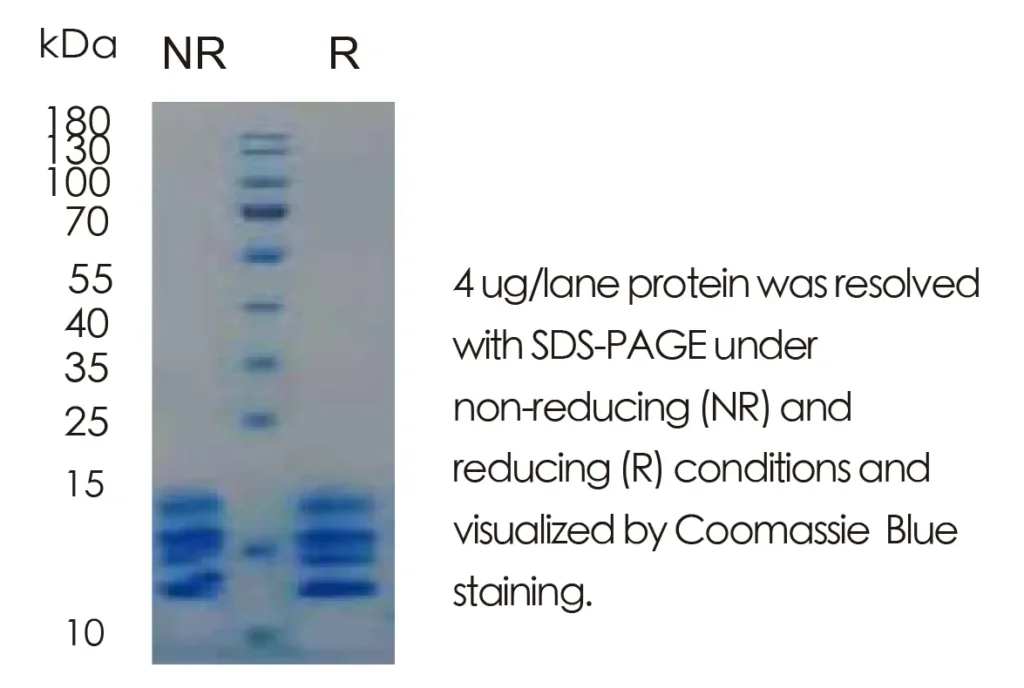 Human CCL2/MCP-1 Recombinant Protein (HEK293 Expression) — Tag Free - Image 1