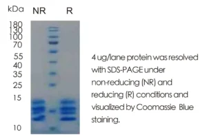 Human CCL2/MCP-1 Recombinant Protein (HEK293 Expression) — Tag Free