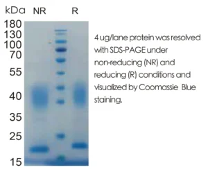 Mouse CCL2 Recombinant Protein (HEK293 Expression)
