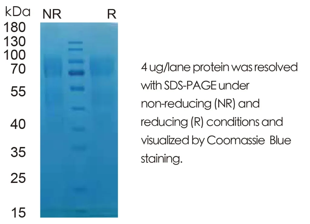 Mouse TPO Recombinant Protein (HEK293 Expression) — Tag Free - Image 1