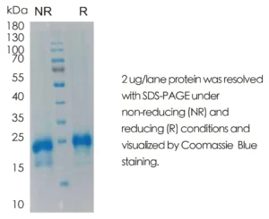 Human R-Spondin 1 Recombinant Protein (HEK293 Expression) — Tag Free