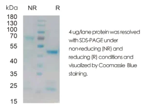 Mouse IL23 Recombinant Protein (HEK293 Expression) — Tag Free