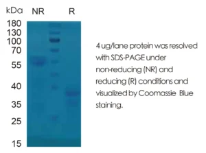 Mouse IL25/mIL17E Recombinant Protein (HEK293 Expression) — Tag Free