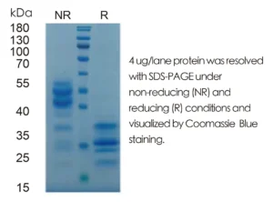 Mouse IL17A Recombinant Protein (HEK293 Expression) — Tag Free