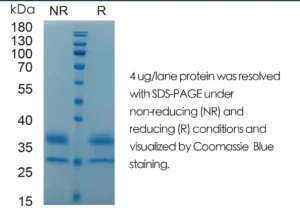 Mouse IL21 Recombinant Protein (HEK293 Expression) — Tag Free