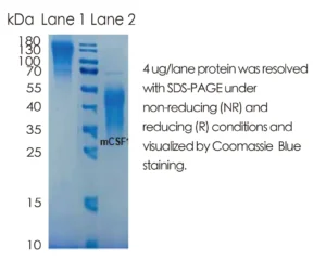 Mouse M-CSF Recombinant Protein (HEK293 Expression)