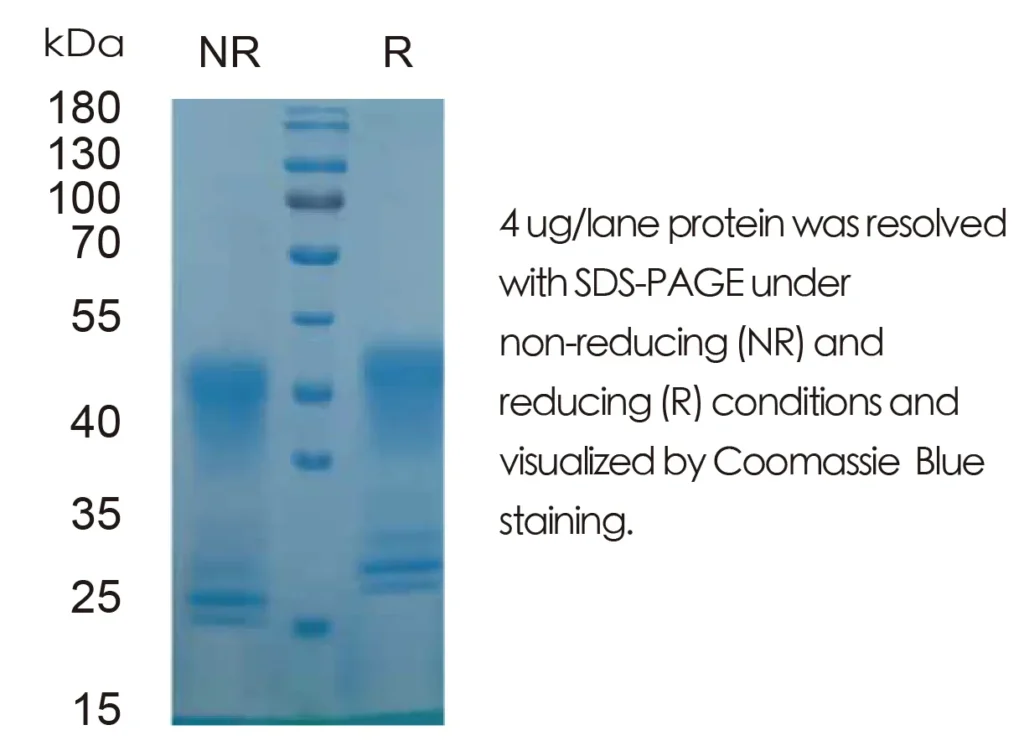 Mouse EPO Recombinant Protein (HEK293 Expression) — Tag Free - Image 1