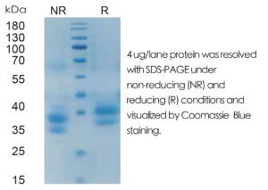 Mouse FLT3L Recombinant Protein (HEK293 Expression)