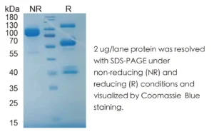 Mouse HGF Recombinant Protein (HEK293 Expression) — Tag Free