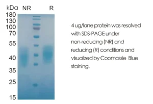 Mouse OSM Recombinant Protein (HEK293 Expression) — Tag Free