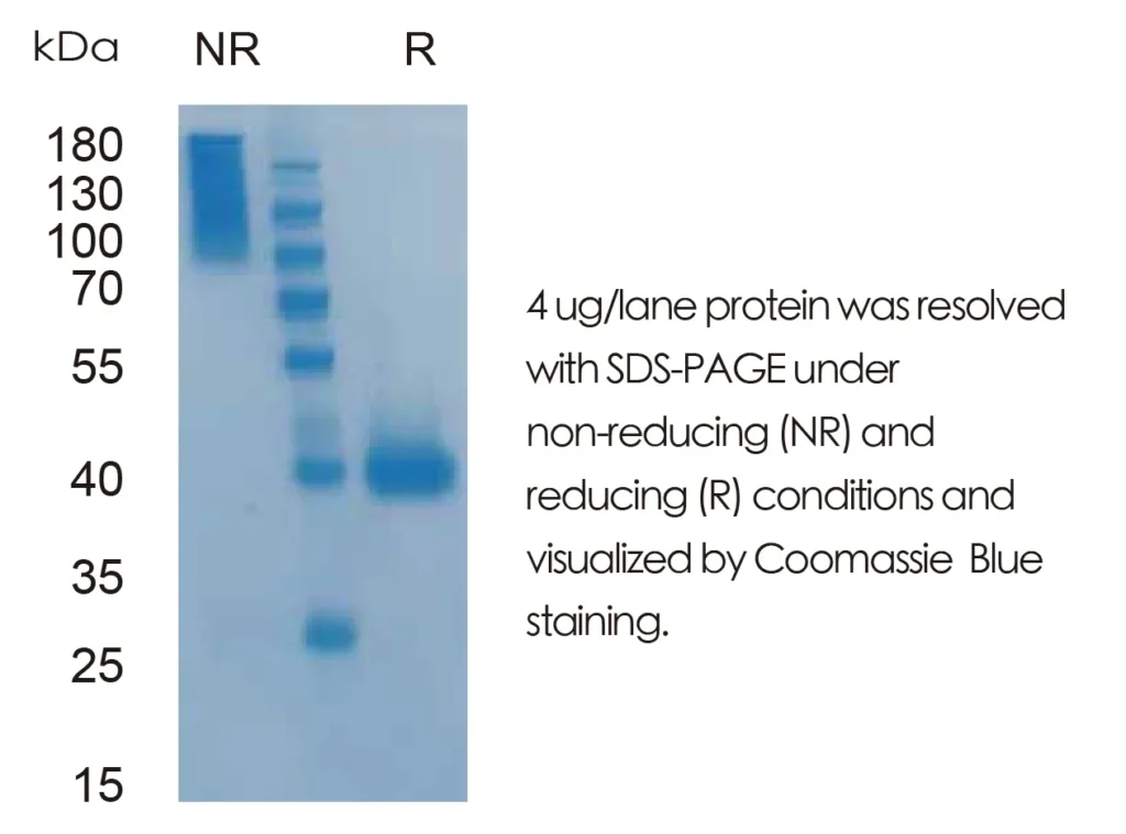 Mouse Noggin Recombinant Protein (HEK293 Expression) — Tag Free - Image 1