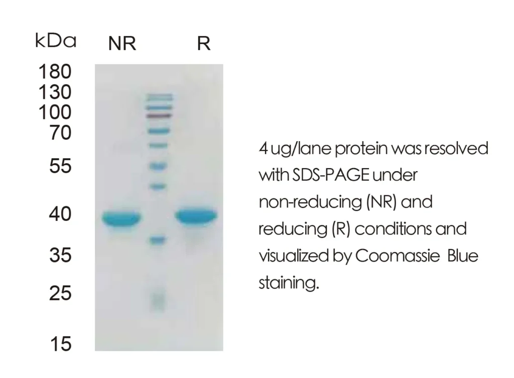 Mouse IFNA2 Recombinant Protein (HEK293 Expression) — Tag Free - Image 1