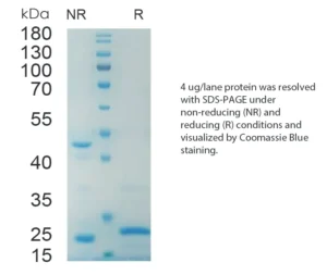 Mouse LEPTIN Recombinant Protein (HEK293 Expression) — Tag Free