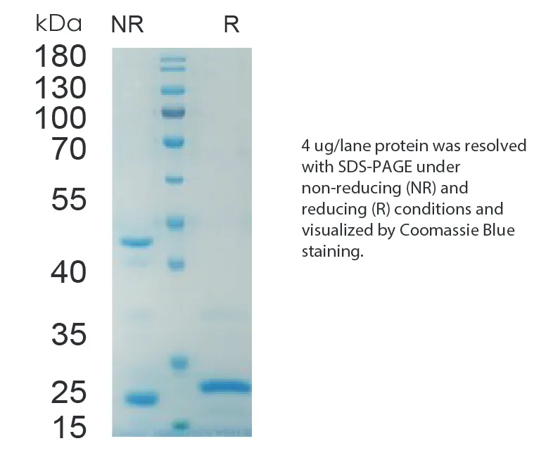 Mouse LEPTIN Recombinant Protein (HEK293 Expression) — Tag Free - Image 1