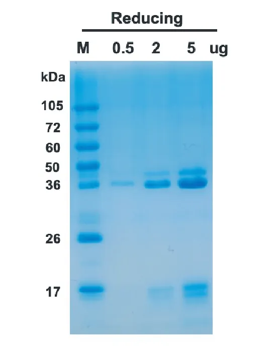 Human IL23 Recombinant Protein (HEK293 Expression) - Image 1