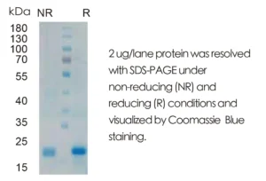 Human IHH Recombinant Protein (HEK293 Expression) — Tag Free