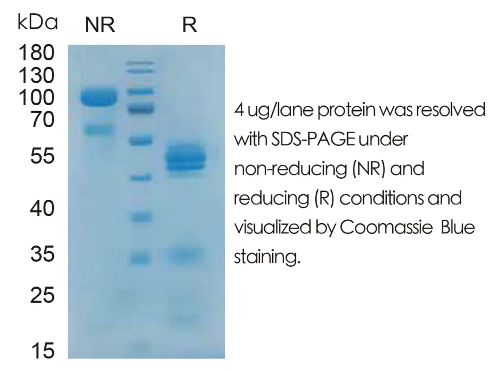 Mouse IL12 Recombinant Protein (HEK293 Expression) — Tag Free - Image 1