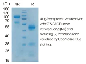 Mouse IL12 Recombinant Protein (HEK293 Expression) — Tag Free