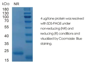 Mouse IL11 Recombinant Protein (HEK293 Expression) — Tag Free