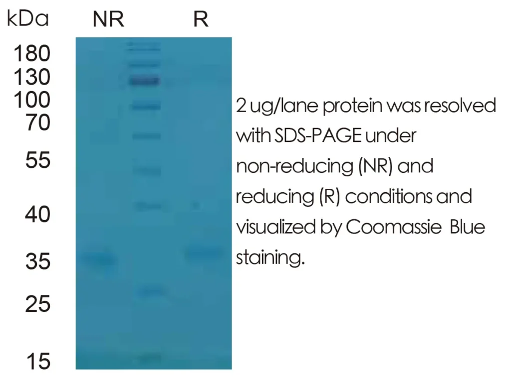 Mouse IL10 Recombinant Protein (HEK293 Expression) — Tag Free - Image 1