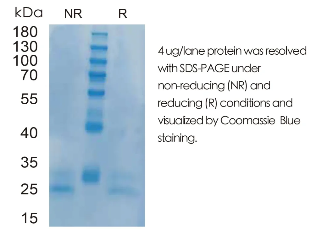 Mouse CCL20/MIP-3A Recombinant Protein (HEK293 Expression) — Tag Free - Image 1