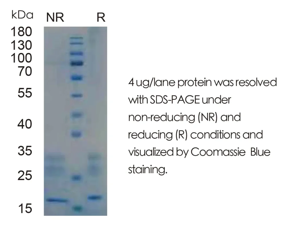 Human CCL20/MIP-3A Recombinant Protein (HEK293 Expression) - Image 1