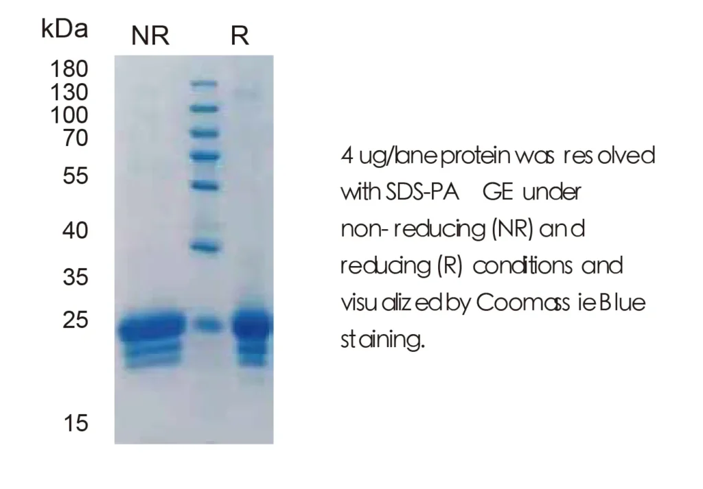 Human IFNB Recombinant Protein (HEK293 Expression) — Tag Free - Image 1