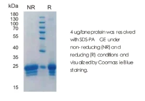 Human IFNB Recombinant Protein (HEK293 Expression) — Tag Free