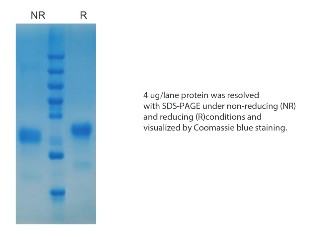 Human IL34 Recombinant Protein (HEK293 Expression) - Image 1