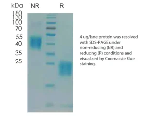 Human PGF Recombinant Protein (HEK293 Expression)