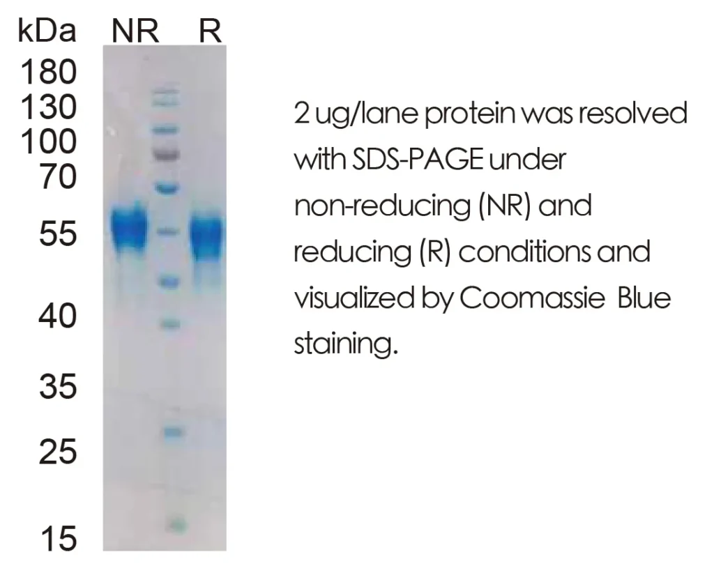 Human DKK1 Recombinant Protein (HEK293 Expression) — Tag Free - Image 1