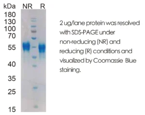 Human DKK1 Recombinant Protein (HEK293 Expression) — Tag Free