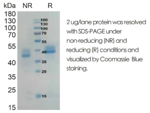 Human IGFBP3 Recombinant Protein (HEK293 Expression)