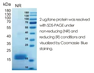 Human DHH Recombinant Protein (HEK293 Expression) — Tag Free