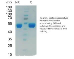 Mouse Renin Recombinant Protein (HEK293 Expression)