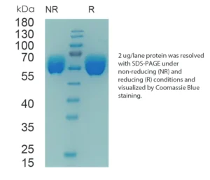 Human AGT Recombinant Protein (HEK293 Expression)