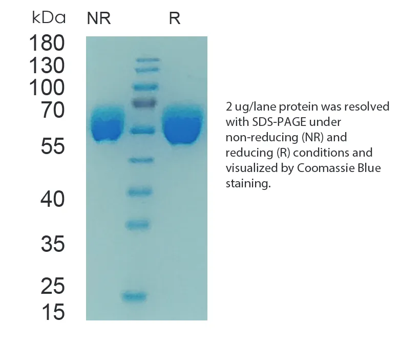 Human AGT Recombinant Protein (HEK293 Expression) - Image 1